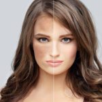 Hair Removal | How to Choose the Right LED Face Mask for Your Skin Concerns Hair Removal | How to Choose the Right LED Face Mask for Your Skin Concerns